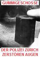 Die Nazi-Polizei Zrich zerstrt in den
                        1980er Jahren mit Gummigeschossen Dutzende von
                        Augen, bis heute (2013)!!!